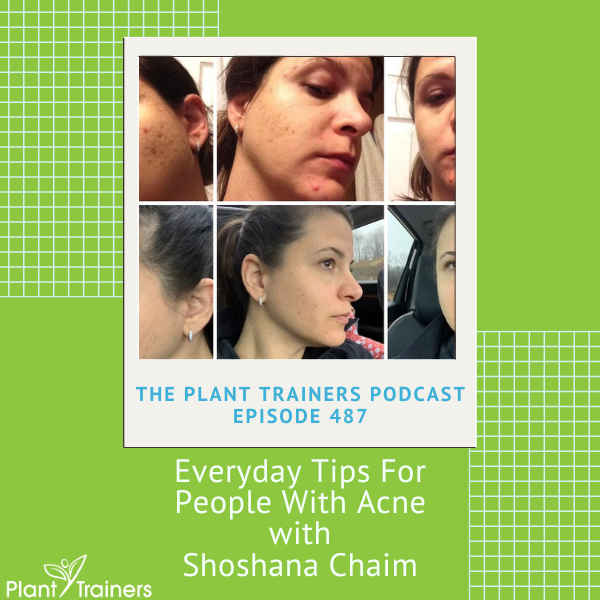 Everyday Tips For People With Acne with Shoshana Chaim – PTP487